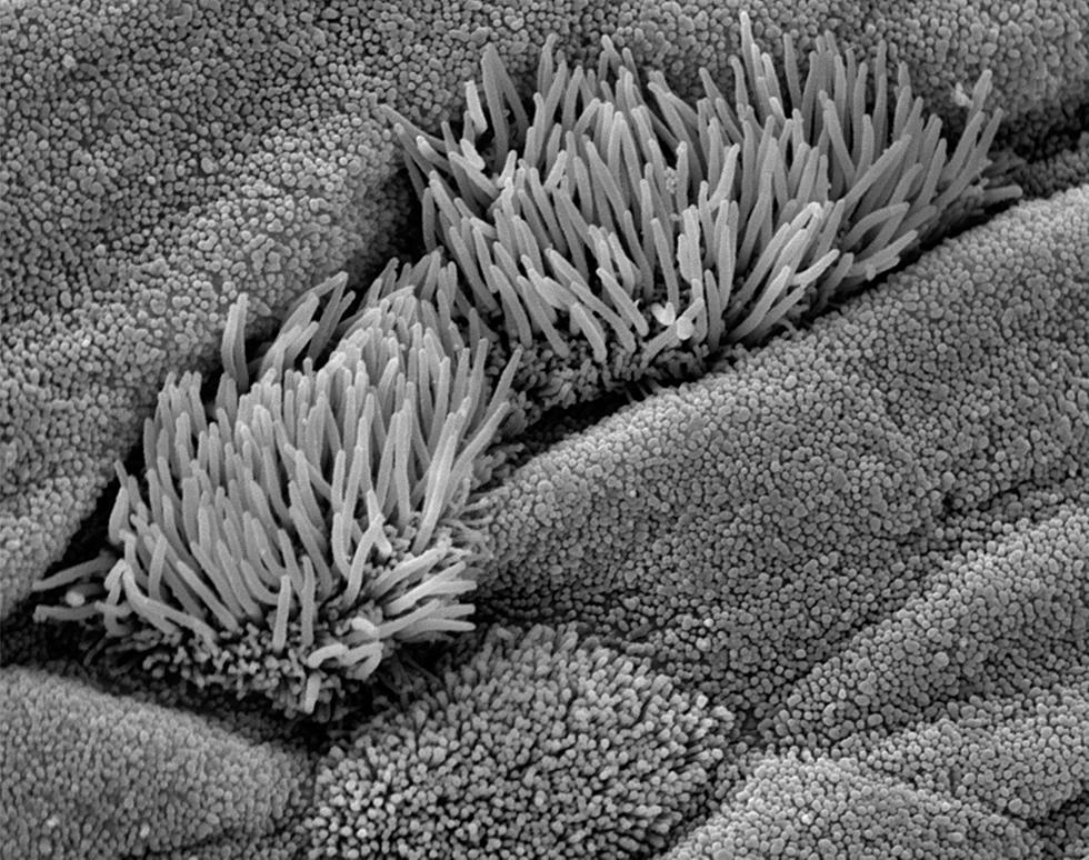 Cilia and microvilli on airway epithelial cells